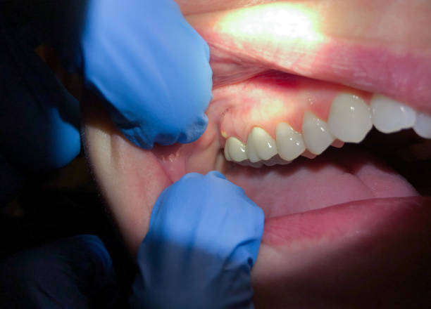 Best Emergency Cosmetic Dentistry (e.g., broken veneers) in North Crossett, AR